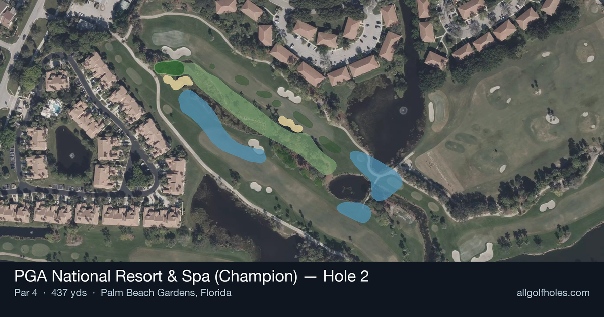 Hole 2 aerial at PGA National Resort & Spa (Champion)