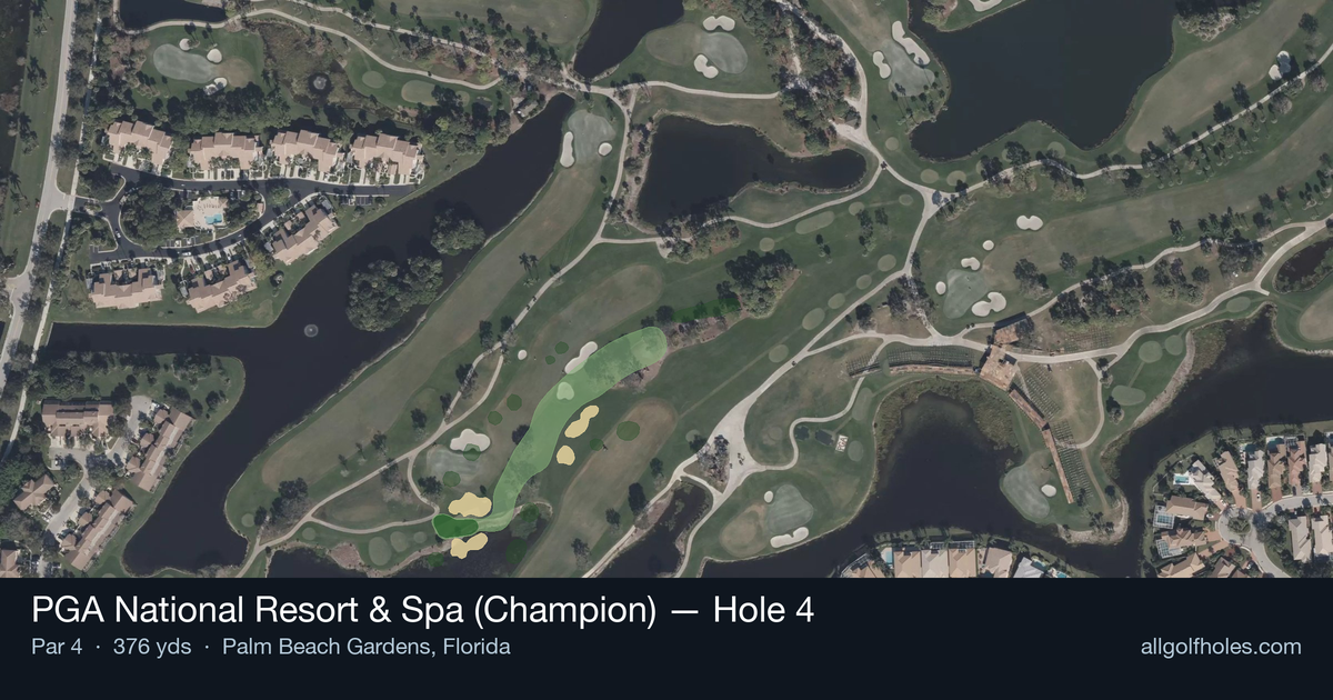 Hole 4 aerial at PGA National Resort & Spa (Champion)