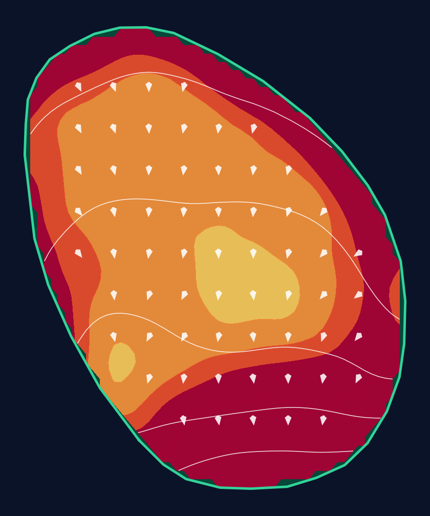 Hole 1 green slope contour at Cascata
