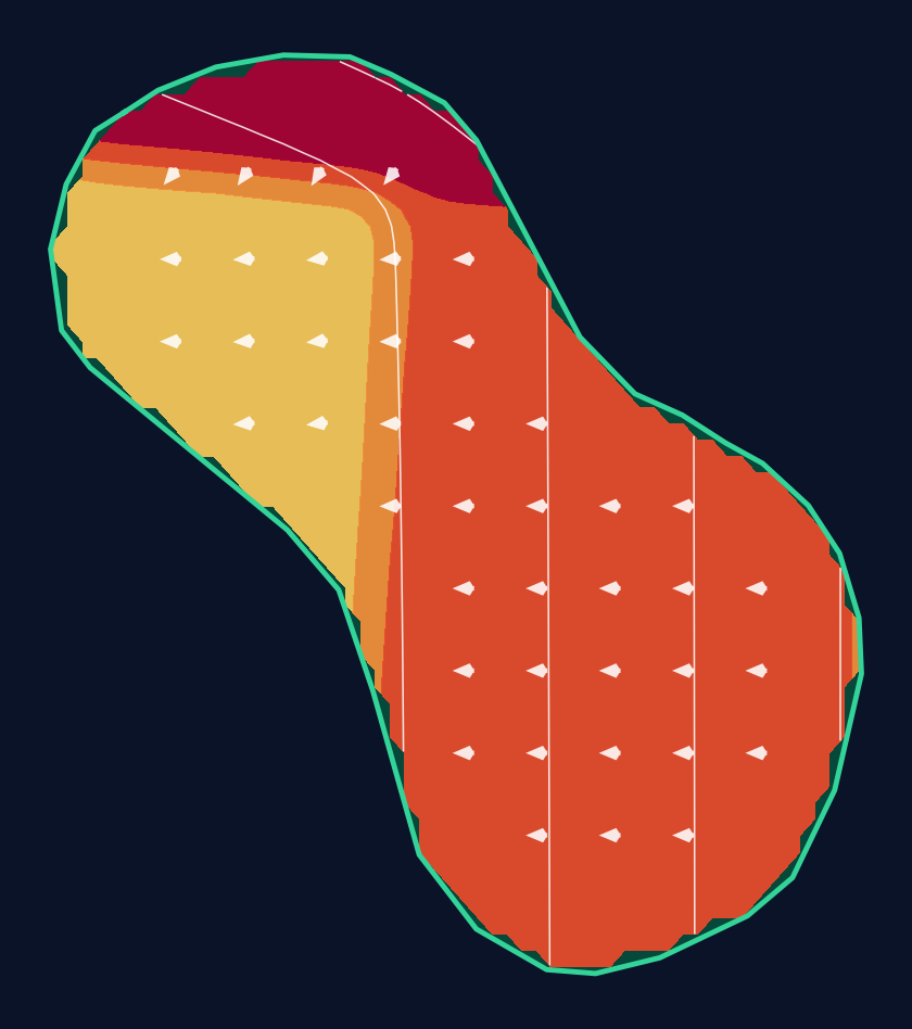 Hole 1 green slope contour at Southern Highlands Golf Club